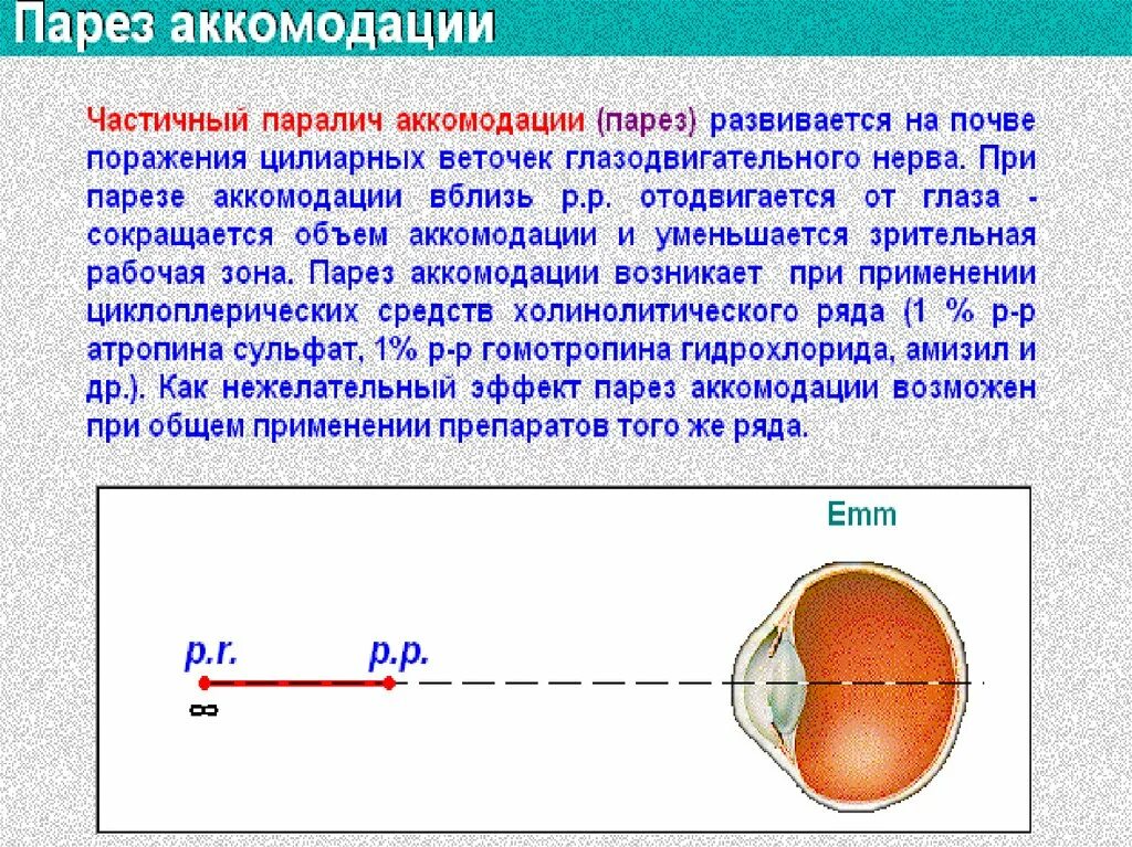 Аккомодация у взрослых. Рефлекс аккомодации глаза схема. Парез и паралич аккомодации. Спазм и паралич аккомодации. Рефракция глаза при спазме аккомодации.