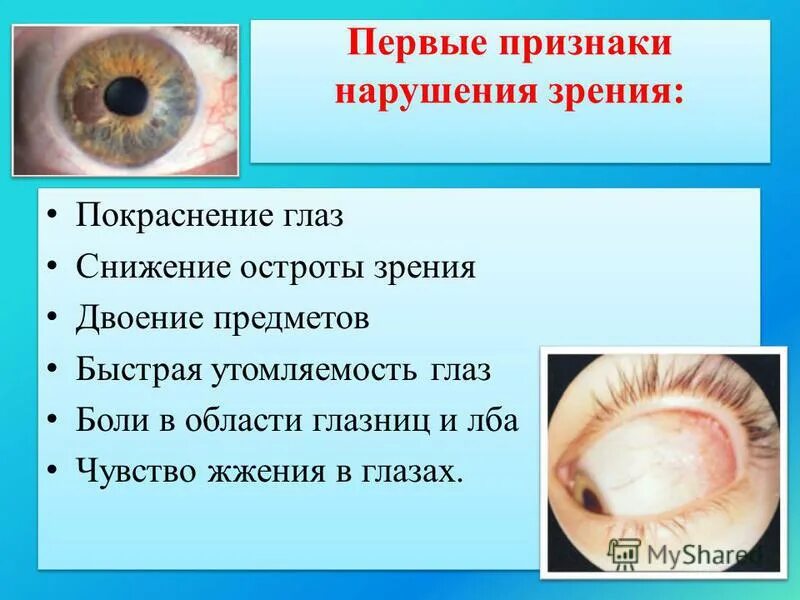 Зрение 1 симптомы. Проявление нарушений зрения. Симптомы ухудшения зрения. Причины плохого зрения. Факторы нарушения зрения.