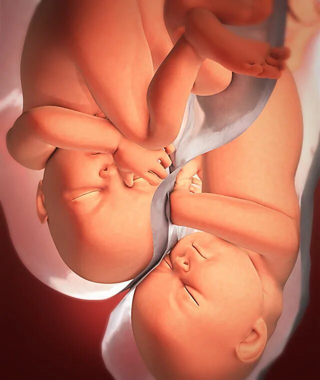 Как лежит малыш в животе. 35 Неделя беременности двойней. Утро ребенка.
