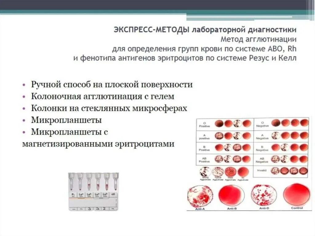 Анализ на резус антитела. Резус-фактор и современный экспресс-метод определения резус-фактора. Лабораторные методы определения группы-крови и резус-фактора. Реакция агглютинации для определения резус фактора. Методика определения резус фактора цоликлонами.