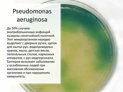 Зеленая мокрота какие антибиотики