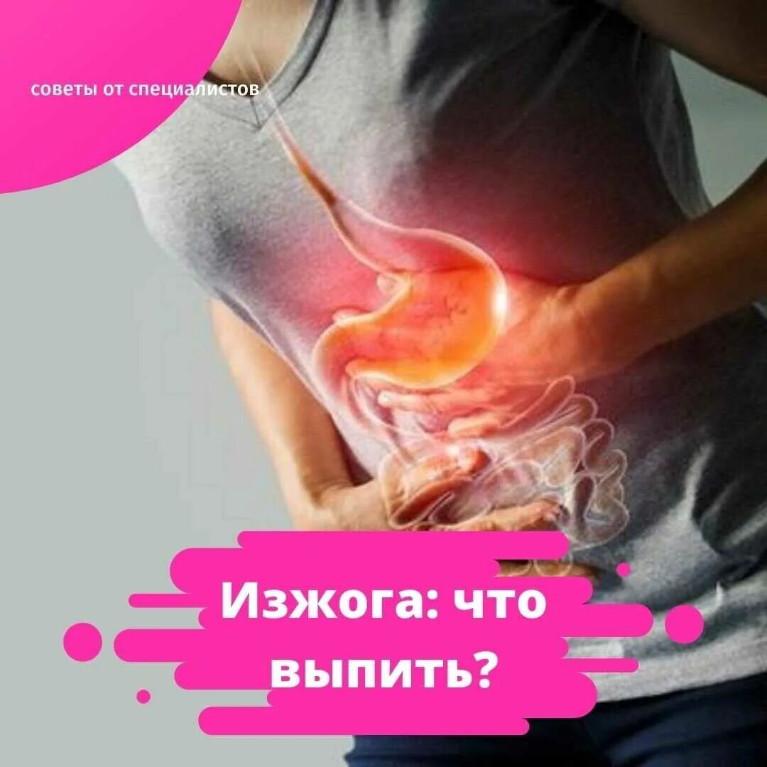 Симптомы изжоги при беременности. Симптомы изжоги желудка. профилактика изжоги.