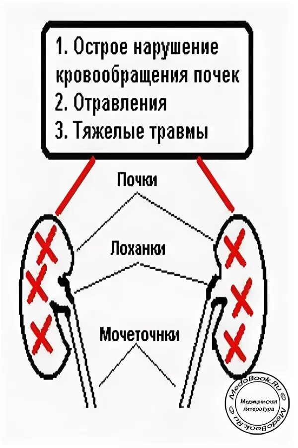 Почему острая кнопка легче