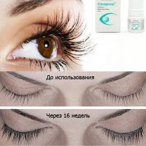Как быстро восстановить ресницы после наращивания. Средство для роста ресниц после наращивания. масло для ресниц после наращивания. препараты для восстановления ресниц после наращивания. рост ресниц после наращивания.