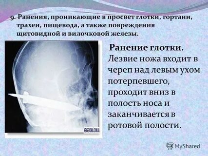Повреждение гортани