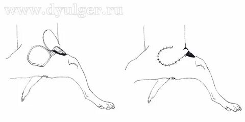 Удаленная н