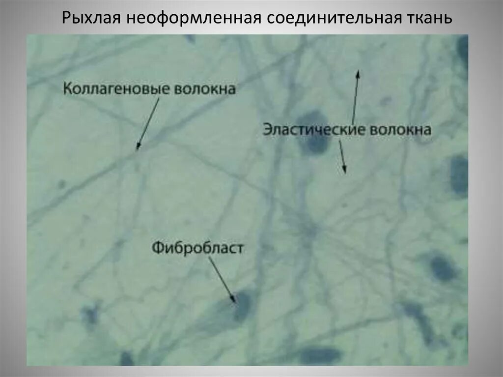 Рыхлая плотная неоформленная соединительная ткань. Рыхлая волокнистая неоформленная соединительная ткань препарат. рыхлая соединительная ткань гистология препарат. рыхлая волокнистая неоформленная соединительная ткань гистология. рыхлая волокнистая соединительная ткань препарат.
