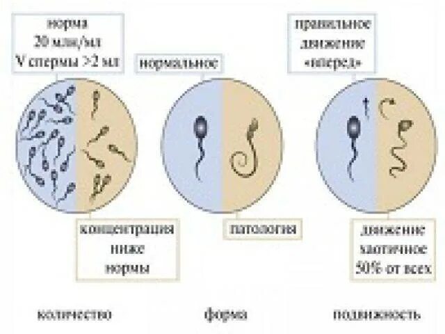 Криптозооспермия и беременность. Как выглядит сперматозоид. Криптозооспермия причины возникновения. Сперматозоид картинка. Что будет если кончить в мужчину