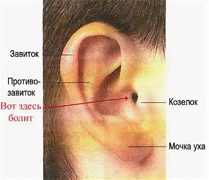 Как понять что болит ухо у ребенка. Отиту детей 1 годик симптомы. Симптомы при среднем отите у детей. Признаки отита у ребенка 1. Симптомы отита у детей до года.