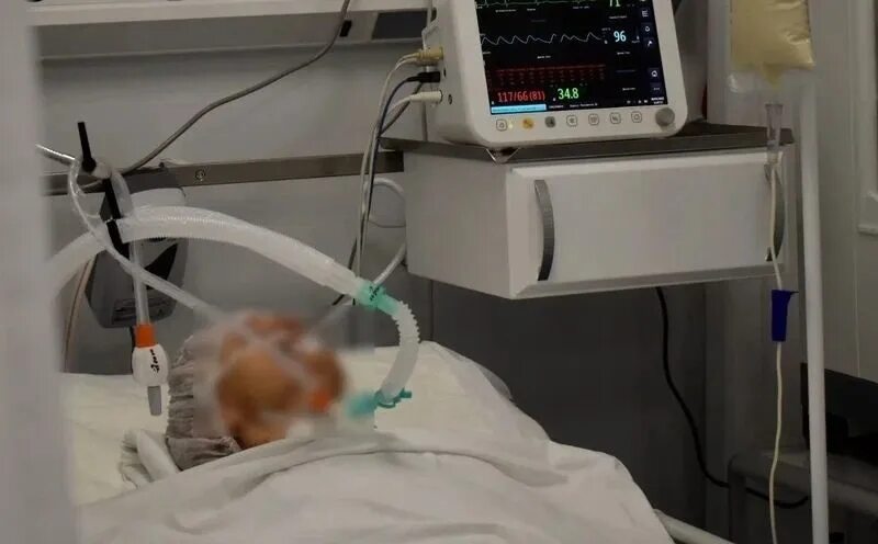 Умершие от гриппа в год. Аппарат в больнице из за давления. Жириновского подключили к аппарату ИВЛ. Искусственный аппарат для коронавируса.