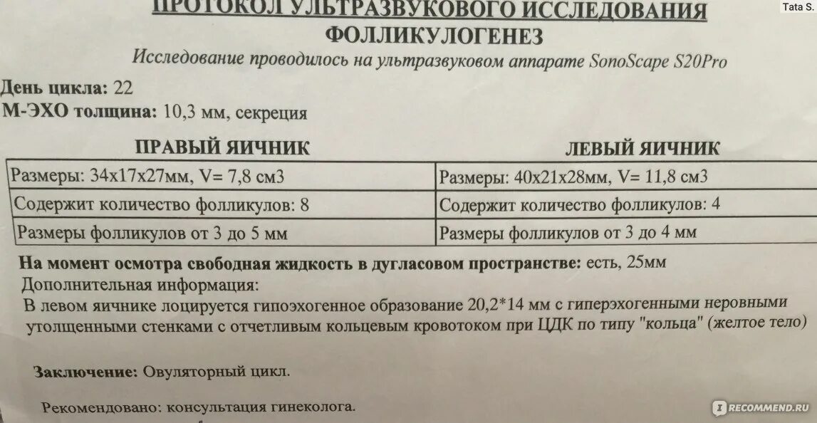 Не лоцируется что это. Лоцируется что это значит. лоцируется. инофолин саше 1г 30. иноферт саше 1г №30.