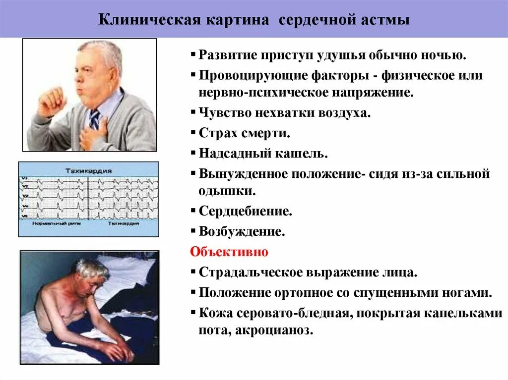 Клинические симптомы приступа бронхиальной астмы. Приступ сердечной астмы. Приступ нехватки воздуха. Клиническая картина сердечной астмы. Отек легких доврачебная помощь