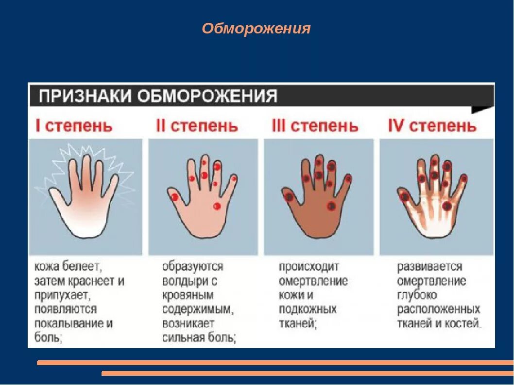 Характерные симптомы отморожений 1 степени:. Характерный признак отморожения III степени. Обморожение 2 степени таблица. Обморожение 1 2 3 степени.