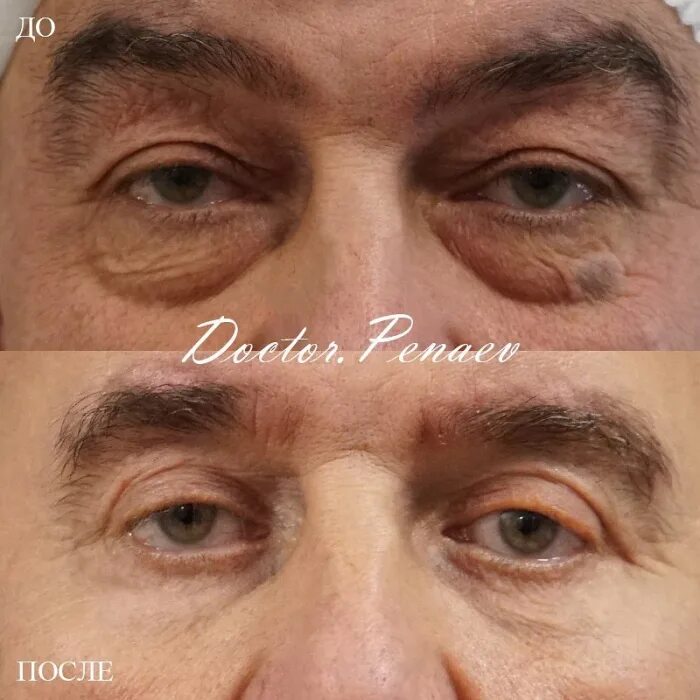 пластический хирург пенаев