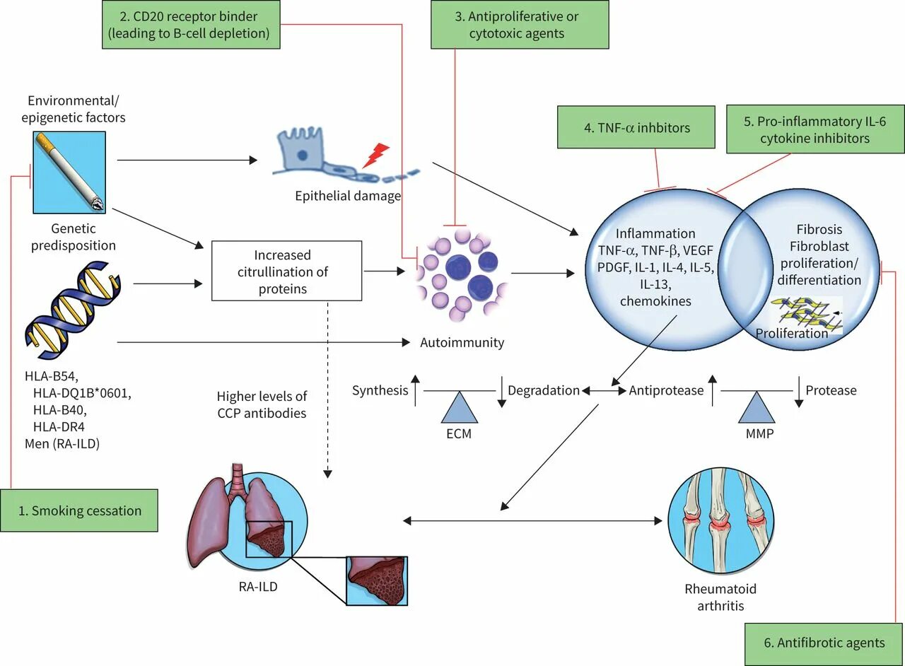 Rheumatoid pathogenesis. Rheumatoid Arthritis (ra) pathogenesis. Mechanism of Rheumatoid Arthritis. Rituximab mechanism of Action. Diseases associated