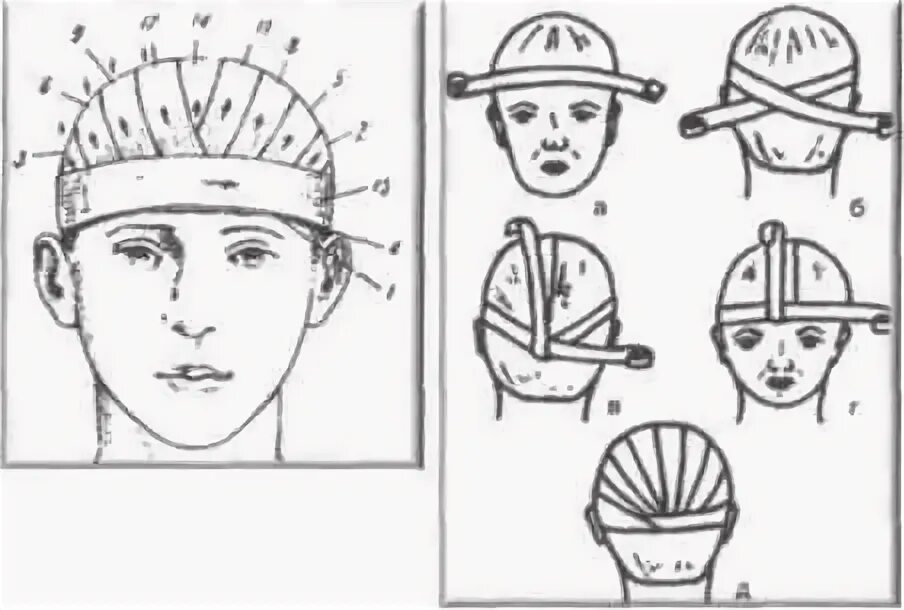 Повязка гиппократа техника наложения. Шапочка Гиппократа алгоритм. Наложение повязки чепец алгоритм. Наложение повязки шапочка Гиппократа алгоритм.