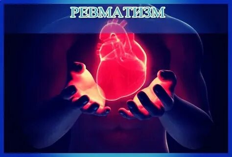 Ревматизм сердца