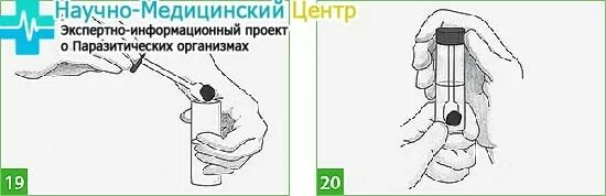 За сколько можно собрать кал на анализы. Как собрать кал на анализ. Правильный сбор кала. Анализ кала сколько. Как собрать калл для анализа.