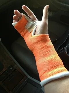 Broken right