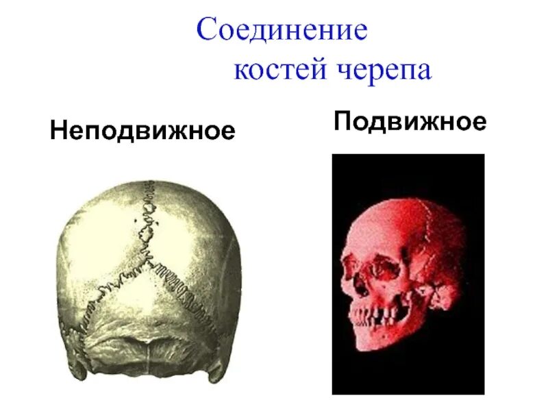 Соединение костей черепа. Соединение кости черепа. Кости черепа соединение костей черепа. Неподвижное соединение костей черепа.