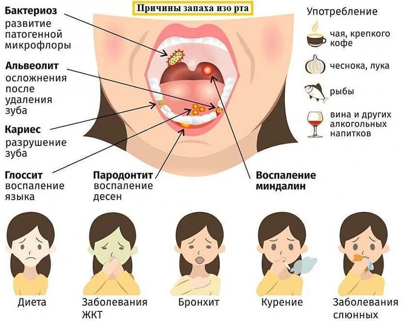 Чувство тошноты в горле. У ребёнка запах изо рта причины. Запах из зо рта причины. Причтнв запаха изо РТП. У ребенка пахнет изо рта причины.