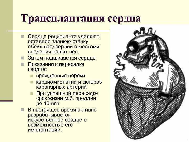 Тест нмо трансплантация сердца наличие трансплантированного сердца. Показания к пересадке сердца. схема пересадки сердца. показания к трансплантации сердца. показания для пересадки сердца.