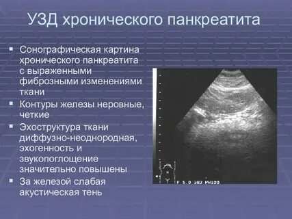 Эхогенность образований на узи