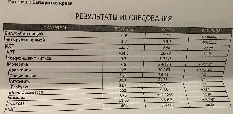 Креатинин анализ повышен у мужчин. Креатинин норма биохимический анализ. Анализ мочевина и креатинин в крови норма. Норма креатинина в анализе биохимии кровь. Биохимия мочевина и креатинин норма.