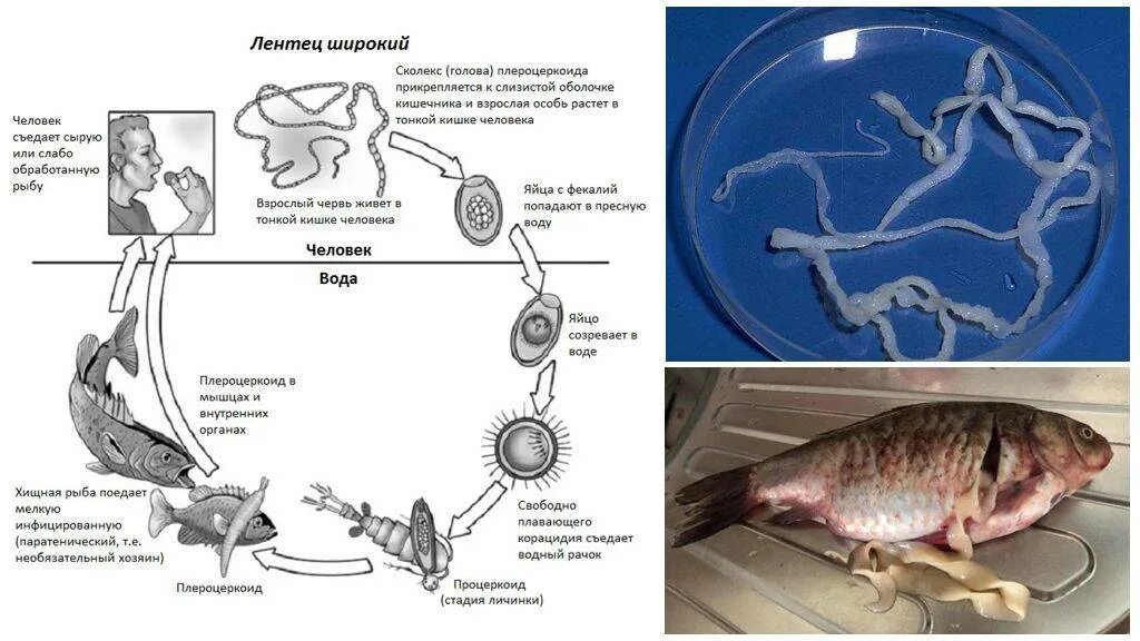 Жизненный цикл широкого лентеца Diphyllobothrium latum. Широкий лентец жизненный цикл схема. Цикл развития лентеца широкого Diphyllobothrium latum. Широкий лентец Diphyllobothrium latum жизненный цикл.