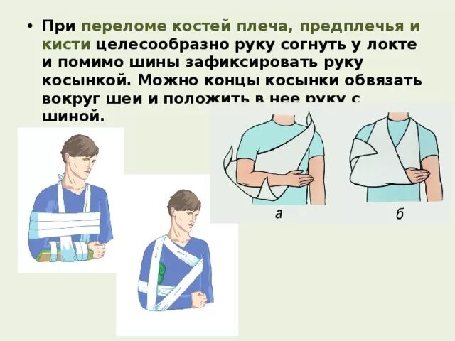 Руку можно двигать при переломе. Транспортная иммобилизация при переломе костей предплечья, кисти. оказание помощи при переломе руки. оказание помощи при переломе плеча. иммобилизация при травме плеча.