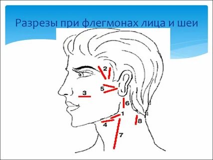 Разрезы на плече