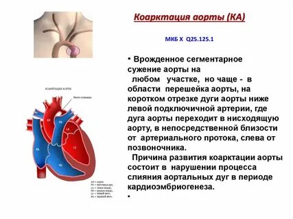 Аортальный порок код по мкб