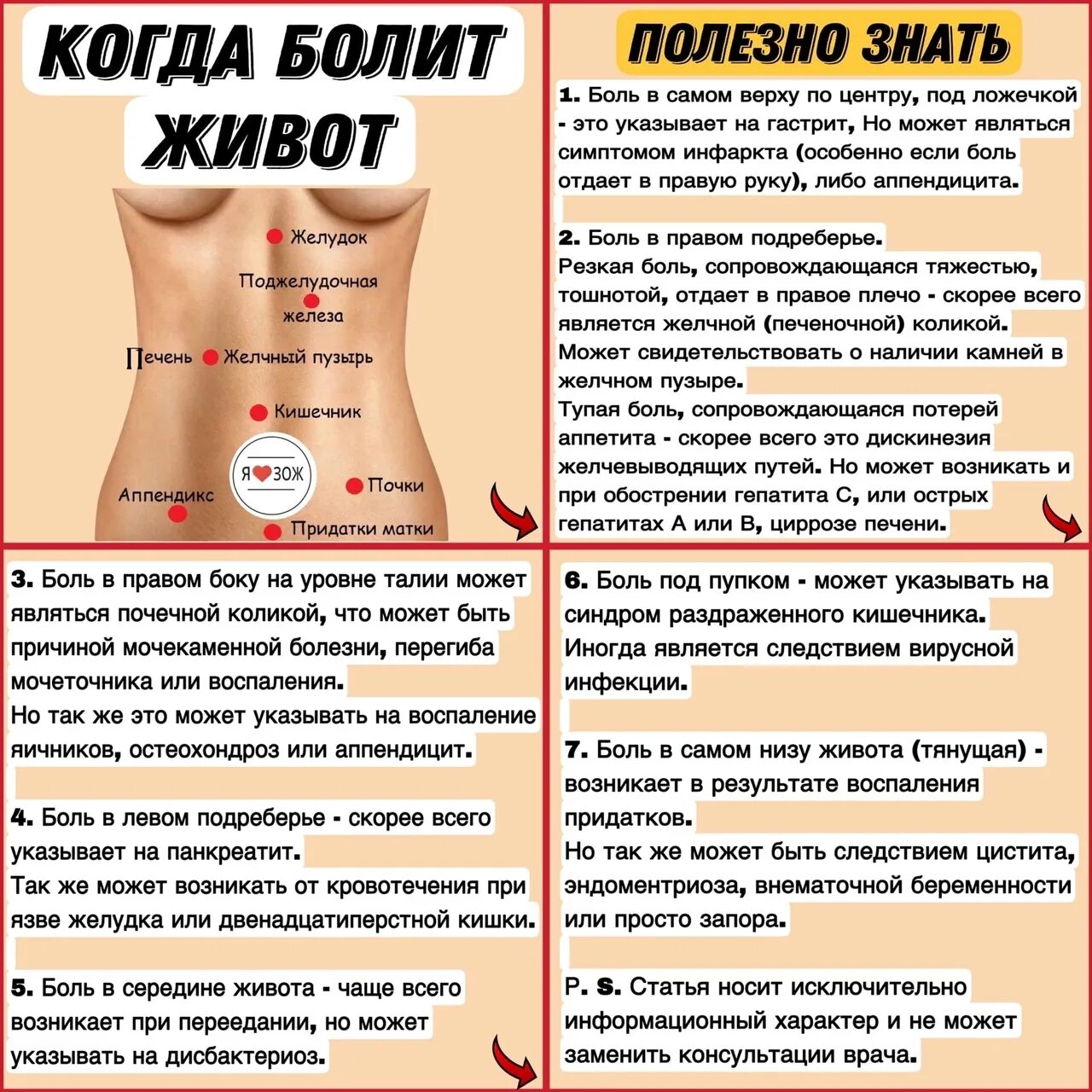 Как сделать так чтобы прошел живот. Схема боли в животе. схема болей в животе у женщин. локализация болей в животе схема.