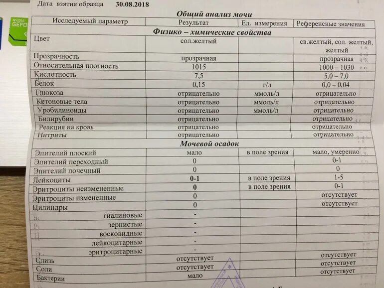 Анализ мочи патологии. Анализ мочи на белок. Белок в моче анализ. Белок 0 066 в моче у ребенка. Общий белок в моче 0.3.