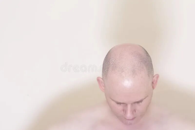 Small bald