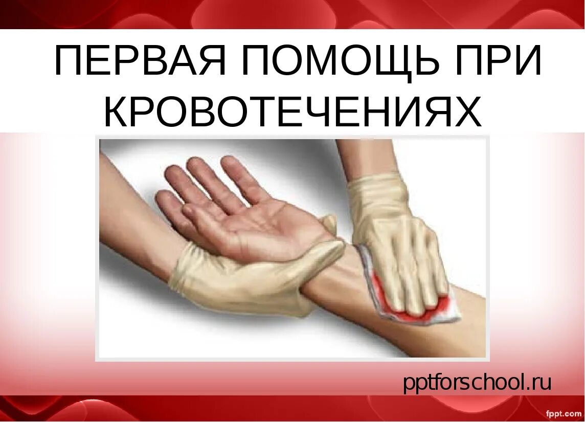 1 помощь при открытом кровотечении. Оказание первой помощи при кровотечении. первая помощь при кровотечениях. первая помощь при крово. первая помощь прии кровотечения.