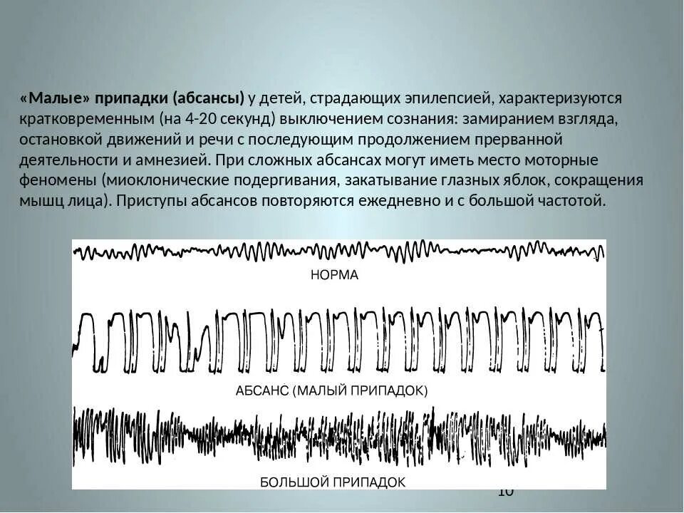 Юношеская абсанс эпилепсия ЭЭГ. Эпилепсия абсансы симптомы. Абсанс малый приступ эпилептический. «Малые» припадки (абсансы). Юношеская эпилепсия