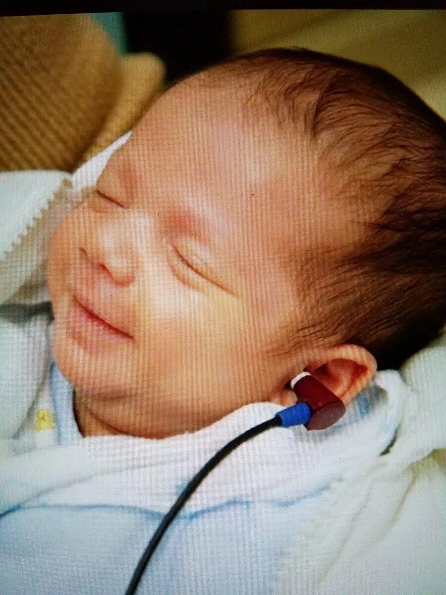 Как проверить слух у новорожденного. Аудиологический скрининг новорожденных. Отоакустическая эмиссия у новорожденных. Аутоскрининг новорожденных. Аудиоскрининг новорожденного.
