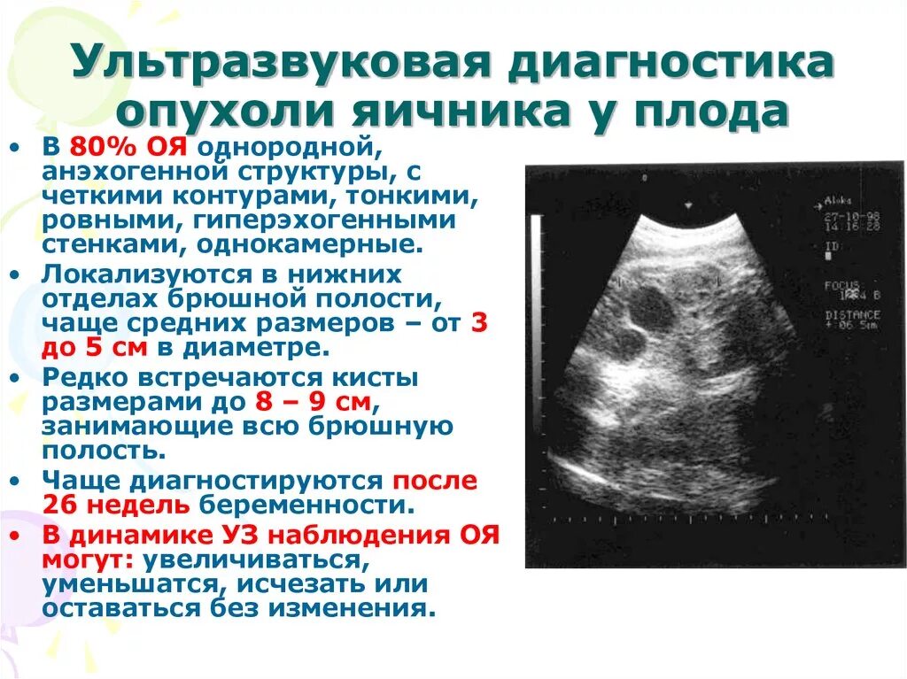 Образование округлое в яичнике