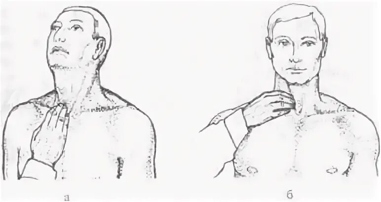 Расположение лимфоузлов на теле человека. Схема расположения надключичных лимфоузлов. Пальпация надключичных и подключичных лимфоузлов. Лимфоузлы ключицы схема. Лимфоузлы ключицы схема.