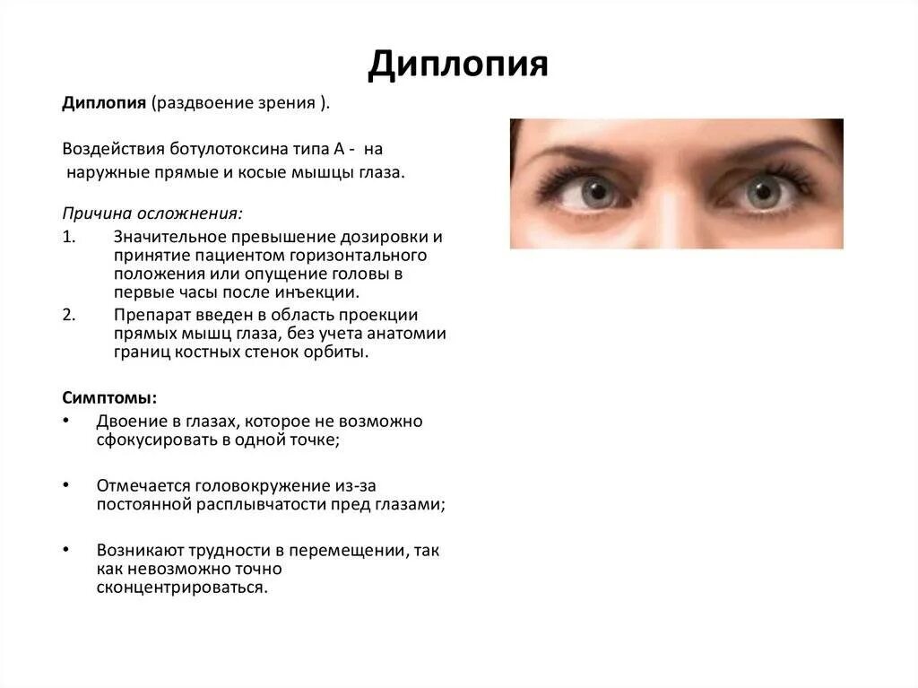 Диплопия причины неврология. Нарушение зрения диплопия. Двоение в глазах диплопия. Lbgkgbz. Двоение в одном глазу