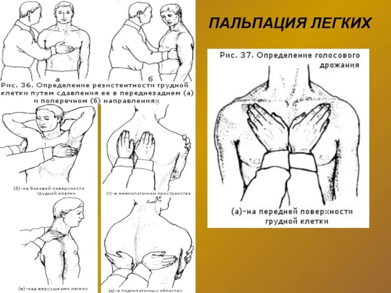 Пальпация перкуссия аускультация легких пропедевтика. Пальпация легких пропедевтика. Пальпация грудной клетки схема. Пальпация грудной клетки пропедевтика.