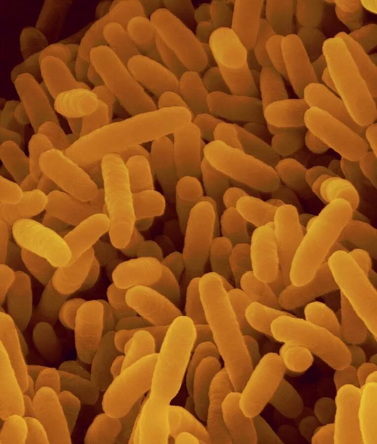 Bacteroides spp что это. Bacteroides thetaiotaomicron. bacteroides forsythus. bacteroides fragilis возбудитель. ruminococcus albus бактерия.