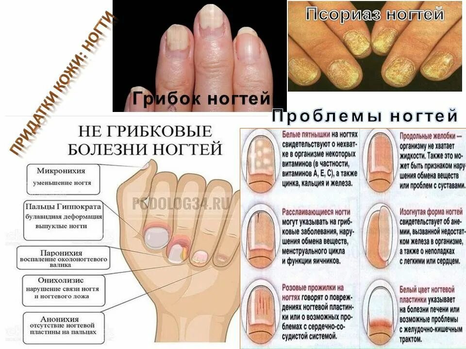 Распространенные заболевания ногтей. Холизис