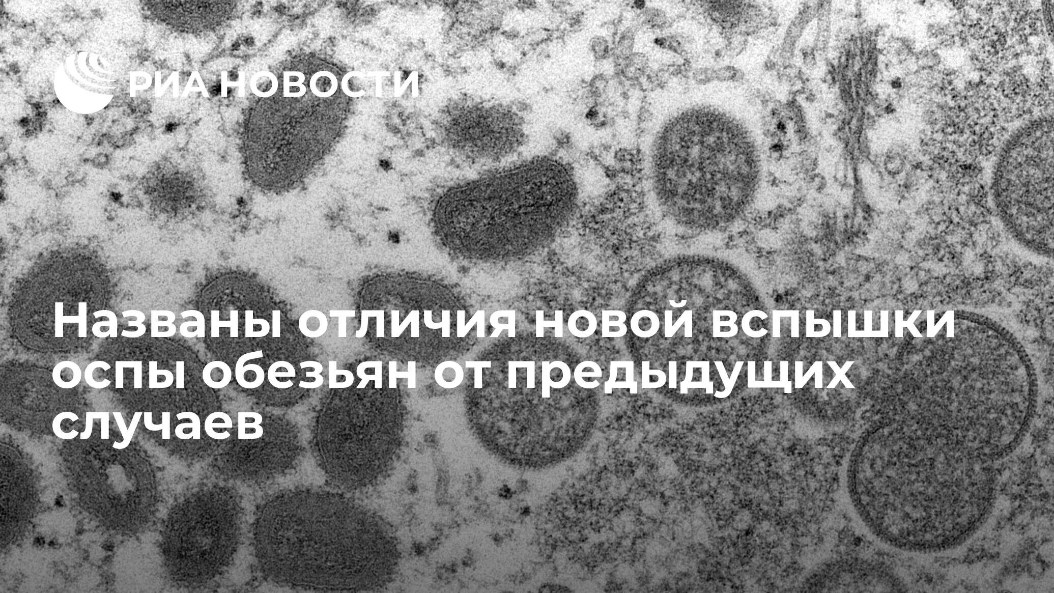 Можно ли вылечиться от оспы обезьян. Обезьянья оспа заражение.