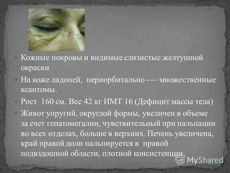 осмотр кожных покровов и слизистых. для пиелонефрита характерны. осмотр кожи и слизистых оболочек алгоритм у детей. сестринское обследование пациента. кожные покровы нормальной окраски.