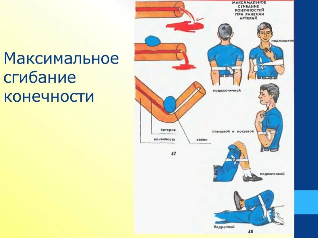 Максимальное сгибание конечности. Максимальное сгибание конечности в суставе. Максимальное сгибание конечности в суставе алгоритм. Максимальное сгибание конечности при кровотечении.