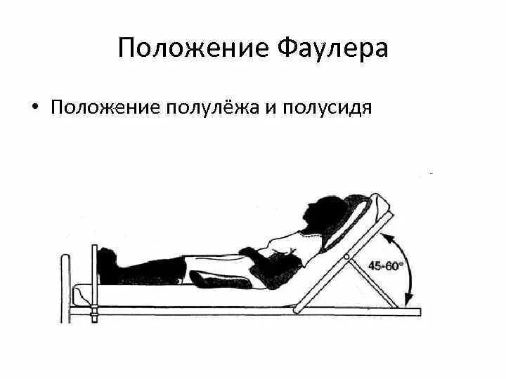 Укладывание пациента в положение Фаулера. Алгоритм перемещение тяжелобольного пациента в положение Фаулера. Укладывание пациента в положение Фаулера симса. Положение Фаулера пациент.