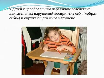 Дцп презентация