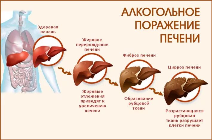 Может ли повысится печени. Печень картинка.